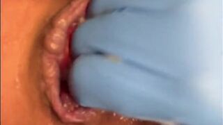 Staceylovesanal Huge Dildo Ass Stretched