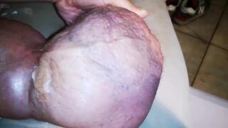 Another Huge Infussion