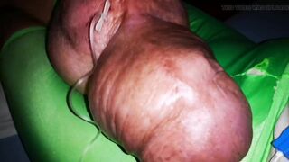 The 3th Liter Glucose