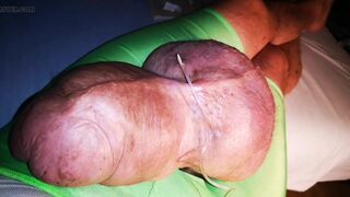 The 3th Liter Glucose